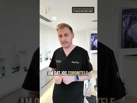 Coroane dentare – tratament protetic de succes și refacerea zâmbetului