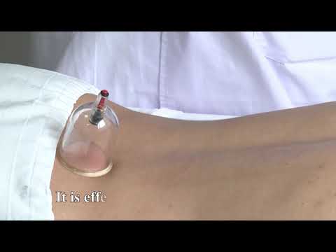 CILIAO (BL32): Alleviate Dysmenorrhea, Ease Lower Back Pain, Promote Blood Circulation 次髎穴：缓解痛经，舒适腰部