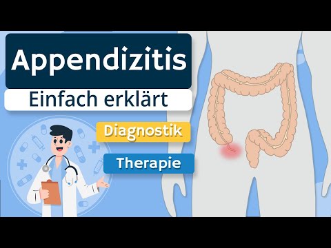 Appendicitis (“appendicitis”) - Pathophysiology, diagnostics, symptoms, and therapy explained