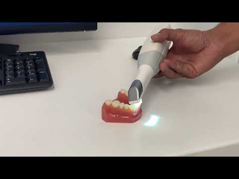 Introduction to dental intra oral scanners