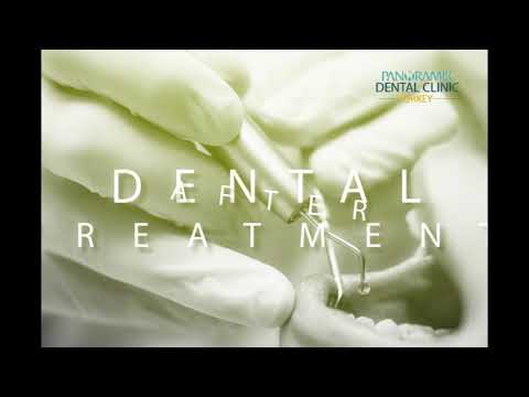 Panoramik Dental Clinic Turkey - Contact Us