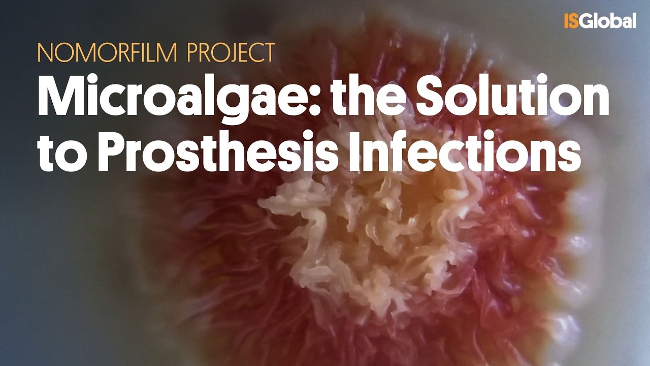 Microalgae Against Prosthesis Infections | NoMorFilm Project (Horizon 2020)