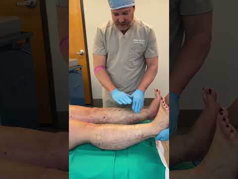 Dr. Hall with a lipedema-surgery patient in the operating room