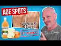Brown AGE SPOT REMEDY Onion Juice And ACV