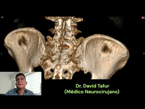 David Tafur Muñoz-3539