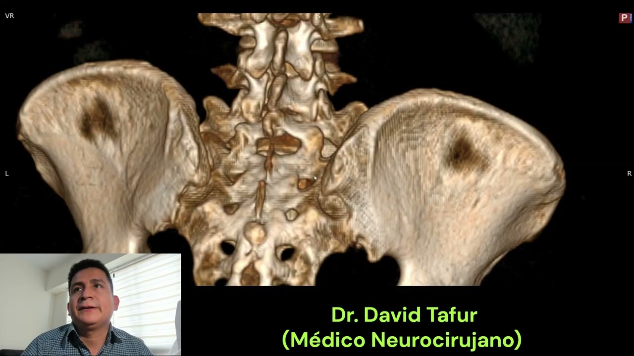 David Tafur Muñoz-2473