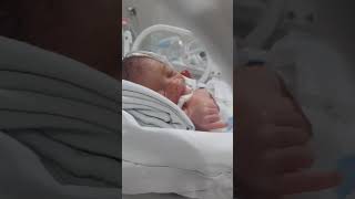 Download lagu Bayi prematur 1kg berjuang hidup sendiri mp3