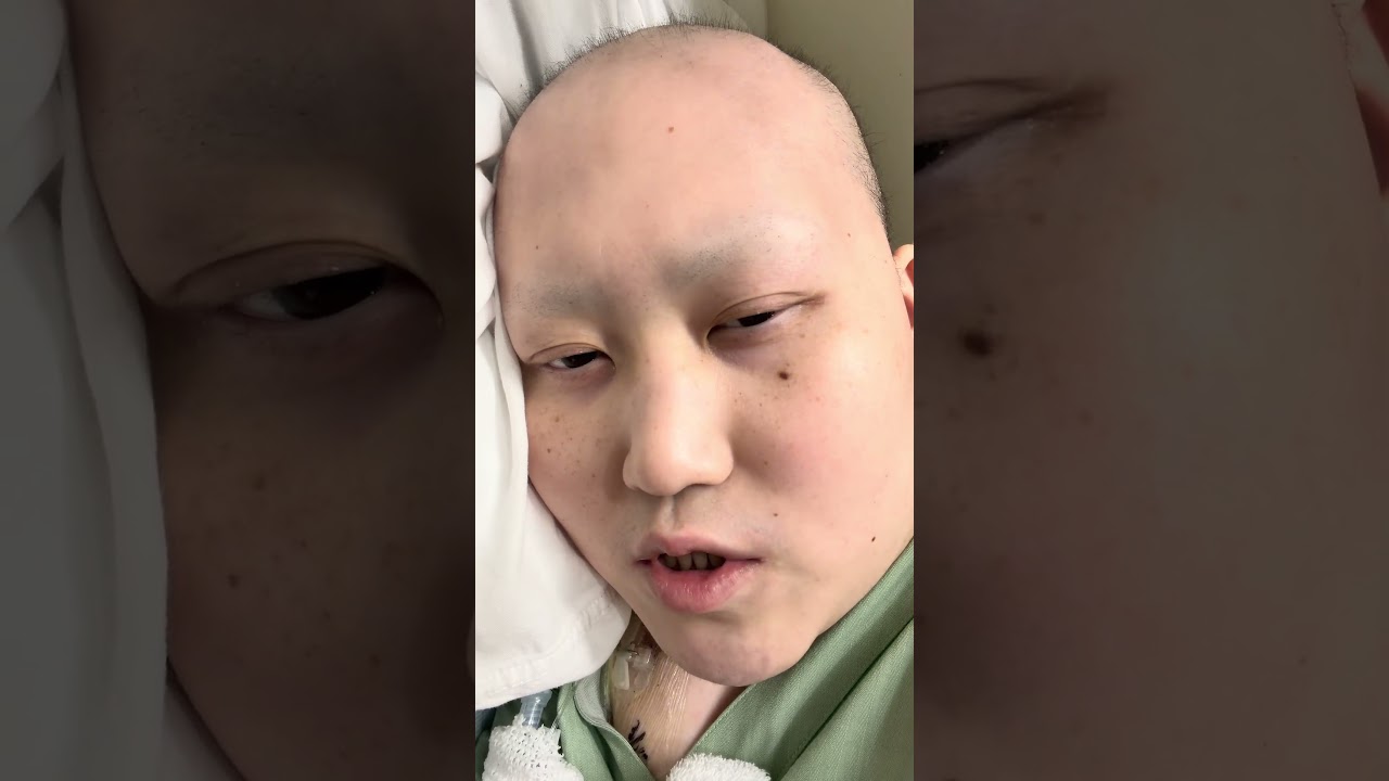 治療も全て無くなり、一生寝たきりになるのが近いと宣告され、遂には身体に穴が空きました…それでも生きたいよ。 #骨肉腫 #05#おすすめ #いいね