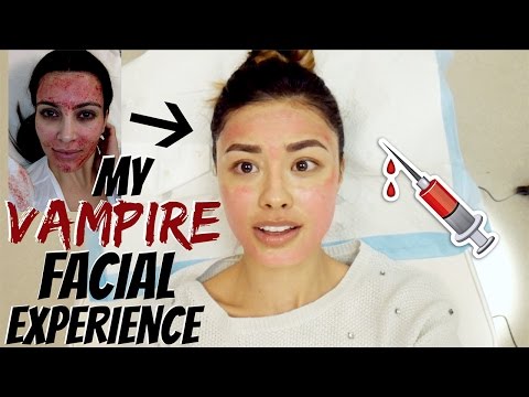 My Vampire Facial Experience | Everything You Need to Know about Micro-Needling with PRP Video