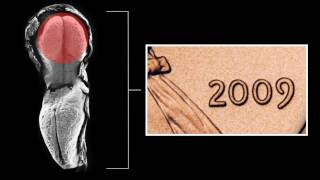 Science 360: The Developing Brain