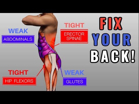 Fix Anterior Pelvic Tilt in 10 Minutes/Day (Daily Exercise Routine)