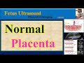 Fetus Ultrasound , Normal Placenta