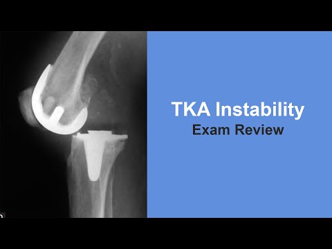 TKA Instability Exam Review - Thomas Sculco, MD