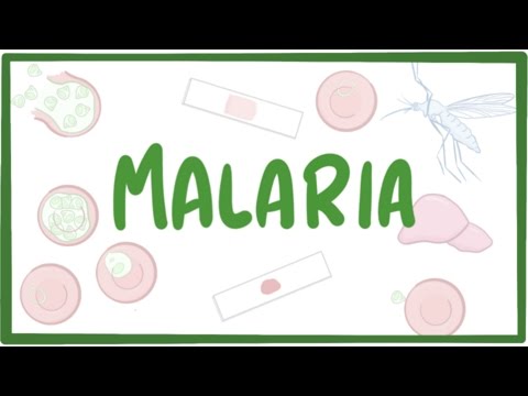 Malaria - causes, symptoms, diagnosis, treatment, pathology