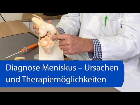 Diagnose Meniskus – Ursachen und Therapiemöglichkeiten