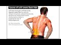 Exercises For Lower Back Pain Part 1