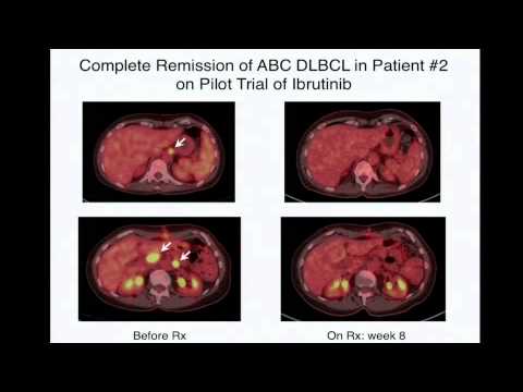 TCGA: Status Report and Insights From Leadership - Louis Staudt