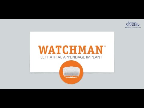 WATCHMAN Implant: Stroke Risk Reduction for AFib Patients