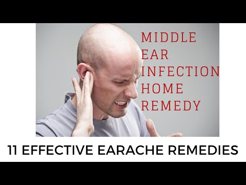 middle ear infection home remedy | 11 Effective Earache Remedies
