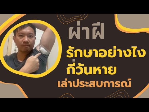 คลิกเพื่อดูคลิปวิดีโอ