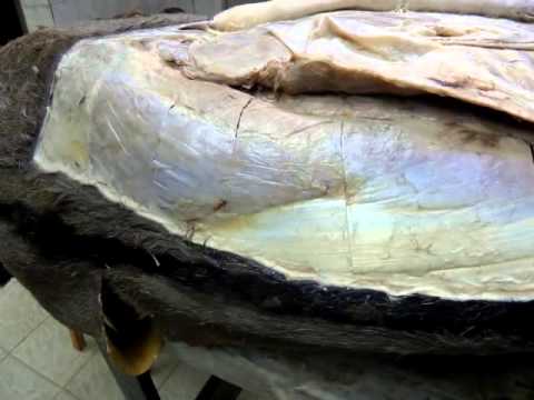 Muscles of the thorax  by dr khaled shoghy