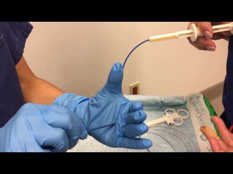 Colon Polyp Removal / Colonoscopy