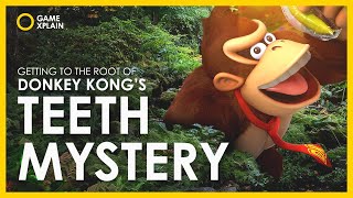 something's up with DK's teeth...