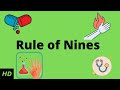 What is Wallace rule of nines?