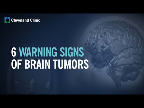 6 Warning Signs of Brain Tumors