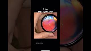 This is what eye doctors see when they look in the back of your eyes. They may dilate or take a pic.