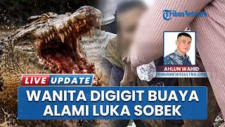 Download lagu Nasib Wanita Bergelut dengan Buaya saat Cari Kerang di Konawe Selatan Sulteng, Betis-Lengan Sobek mp3 Download lagu Nasib Wanita Bergelut dengan Buaya saat Cari Kerang di Konawe Selatan Sulteng, Betis-Lengan Sobek mp3