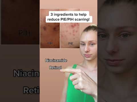 3 Ingredients to help reduce PIE/PIH Scarring
