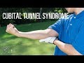 Cubital tunnel syndrome: Signs, symptoms and treatment of this ulnar nerve injury