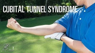 Cubital tunnel syndrome: Signs, symptoms and treatment of this ulnar nerve injury