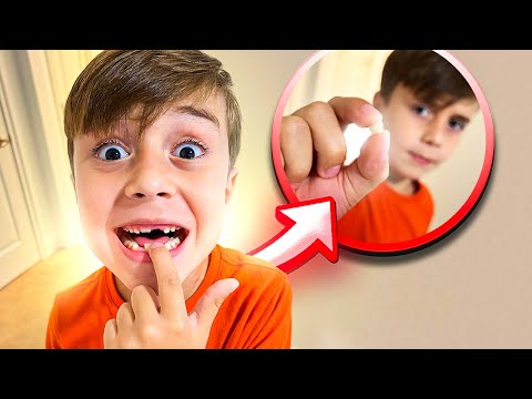 CONSEGUIMOS TIRAR O DENTE DO MARCOS - Família Brancoala