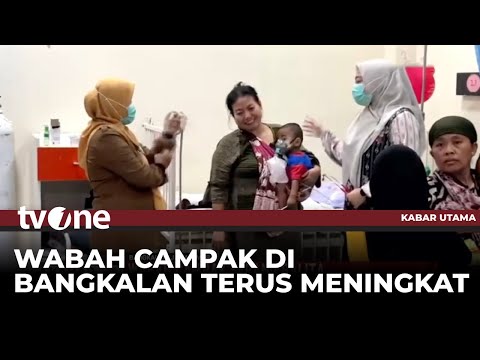 Wabah Campak Merebak, Kabupaten Bangkalan Status Darurat Campak | Kabar Utama tvOne