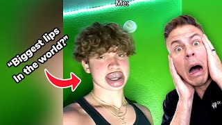 The Biggest Lips In The World?! Orthodontist Reacts!