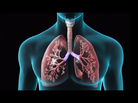 Determining the Impact of CAT Score in Chronic Obstructive Pulmonary Diseases Patients Health