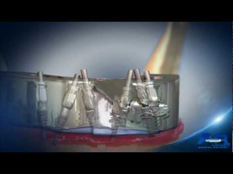 İmplant Çözümortağımız A.B Dental Devices 9