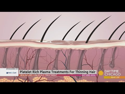 Platelet Rich Plasma Treatments For Thinning Hair
