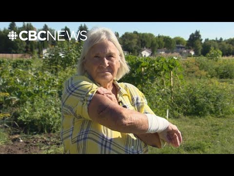 75-year-old Saskatoon woman recounts attack in community garden