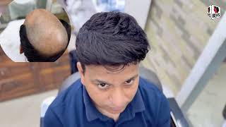 Hair Patch For Men | Hair Patch Work | Non Surgical Hair Treatment | 9599858612 |