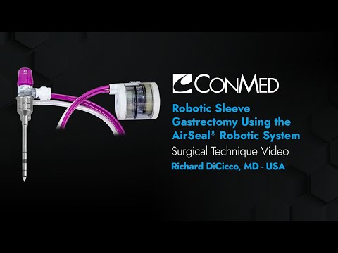 Dr. Richard DiCicco - Robotic Sleeve Gastrectomy Using the AirSeal® Robotic Solution - CONMED