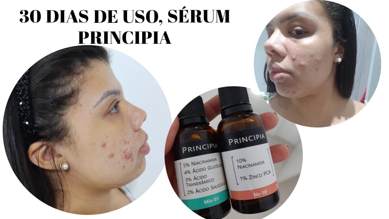 TESTEI SÉRUM PRINCIPIA, NC10 + MIX-1.  30 DIAS DE USO, RELATO SINCERO COM FOTOS #sérumprincipia