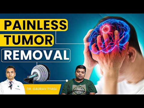 I Tried Radiosurgery For My Brain Tumor And It Changed EVERYTHING