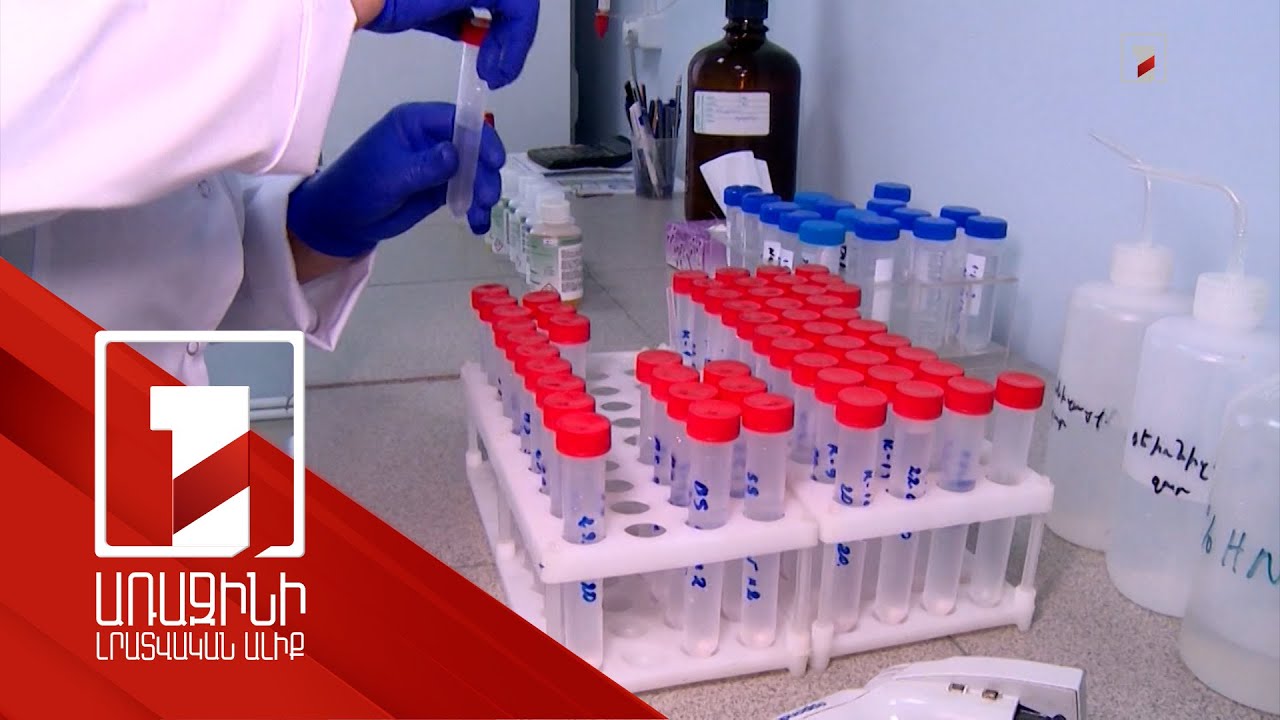 ՀՀ-ում ՄԻԱՎ-ով ապրող մարդիկ դեռևս ենթարկվում են խտրականության