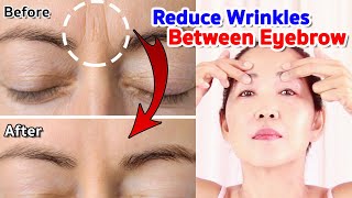 Reduce Wrinkles between eyebrows - Frown Lines | NO TALKING | Antiaging