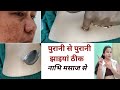 Nabhi Massage Ke Fayede झाइयां Melasma Glowing Skin Acne Pimple दूर Gudiya Janvi