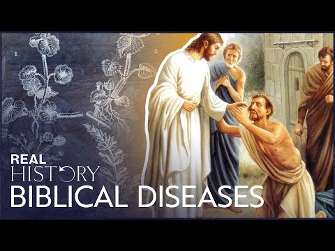 The Diseases & Medicine Of The Biblical Times | Living In The Time Of Jesus