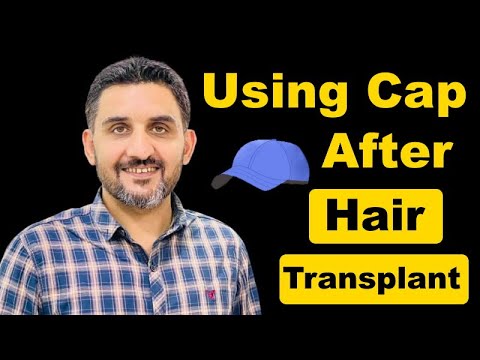 Using Cap or Helmet After Hair Transplant || Can we use Cap after Hair transplant